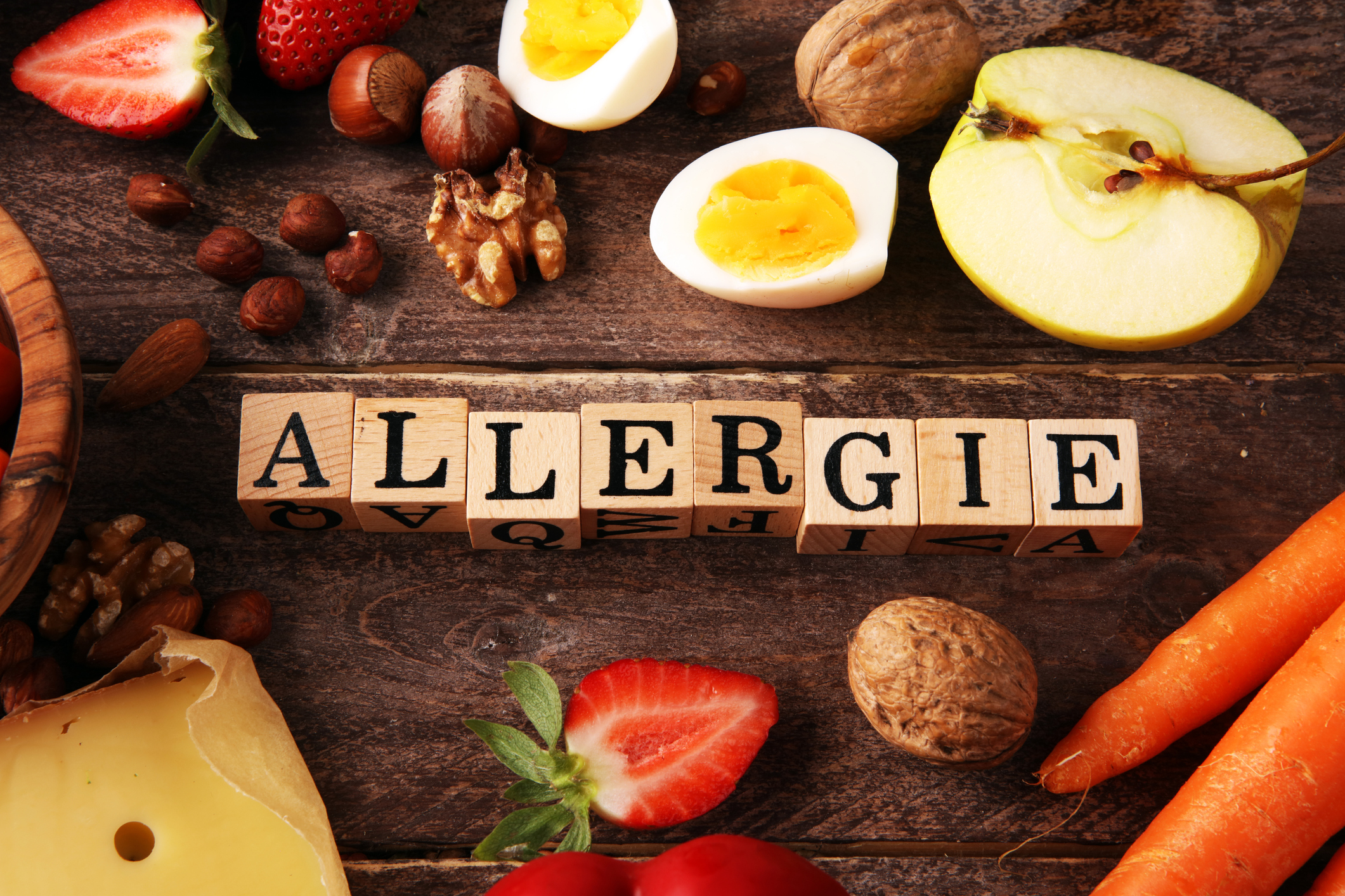 ALLERGIEN